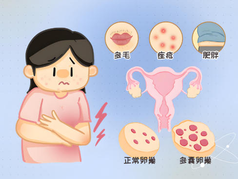 泰安俪人医院巢综合症