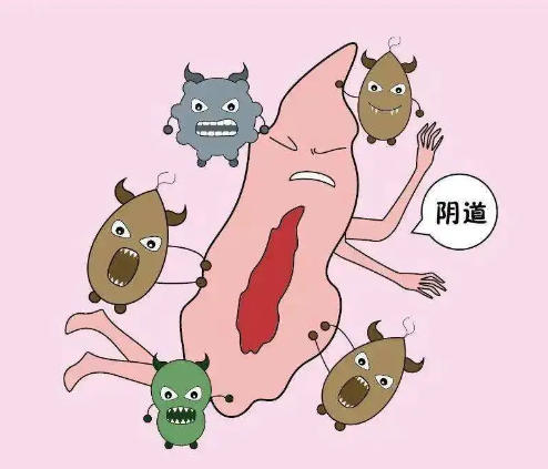 外阴瘙痒