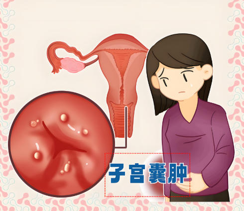 泰安俪人医院子宫囊肿 泰安俪人医院子宫囊肿