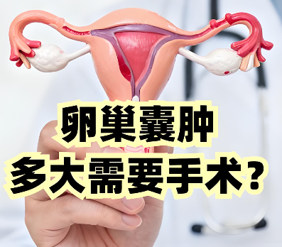 泰安俪人医院卵巢囊肿