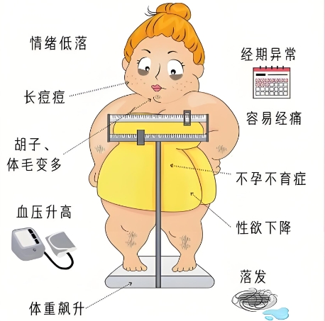 泰安多囊卵巢综合症