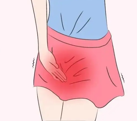 外阴瘙痒 外阴瘙痒