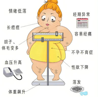 多囊肿卵巢