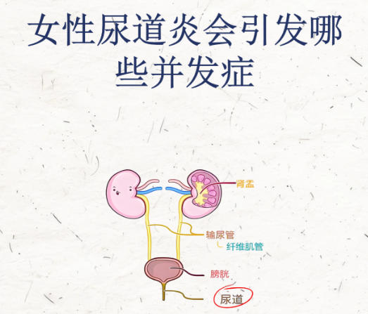 女性尿道炎 女性尿道炎